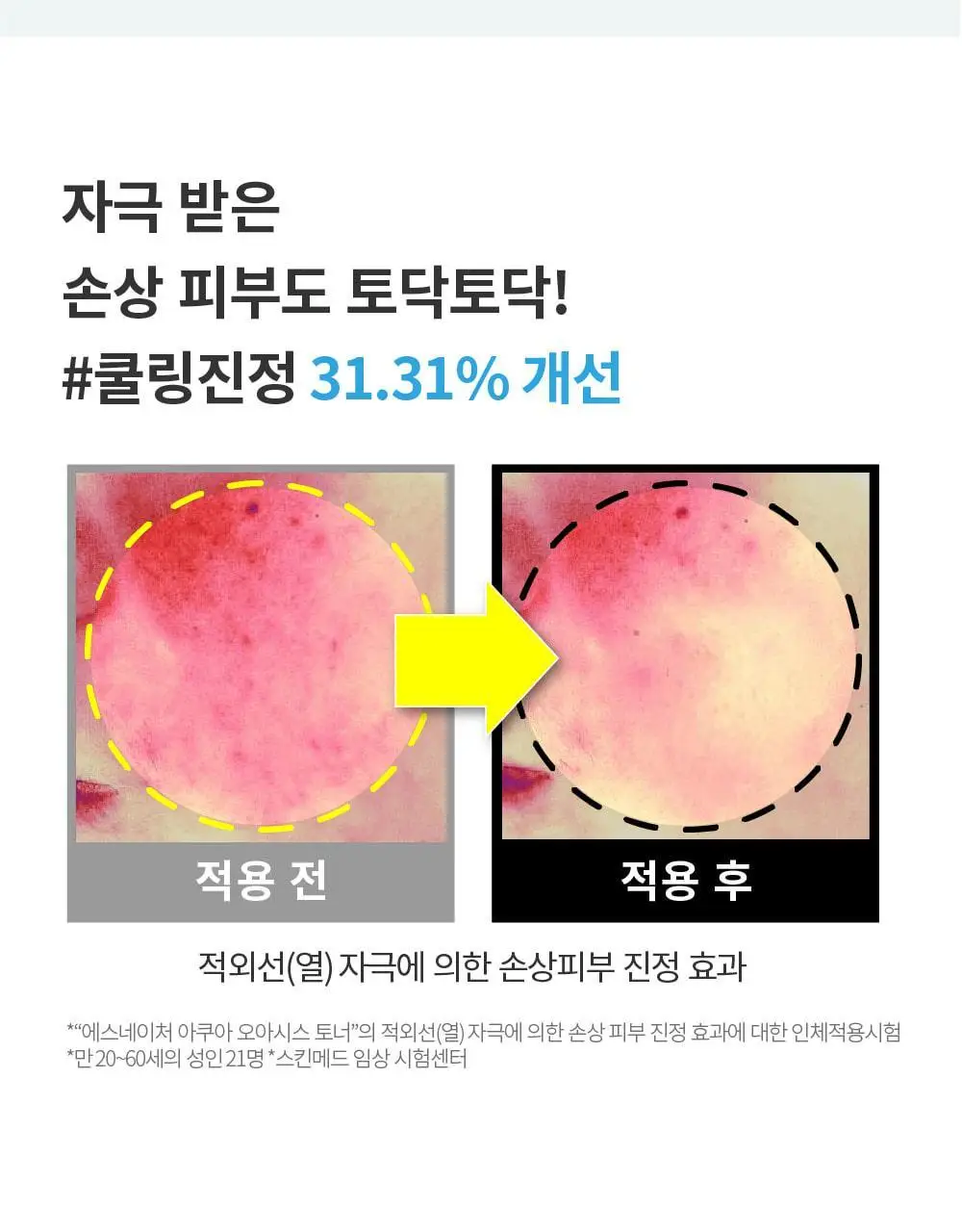 [속촉촉진정/화해1위 토너] 에스네이처 아쿠아 오아시스 토너 300ml 기획 (+젤크림 30ml) 상세페이지 19
